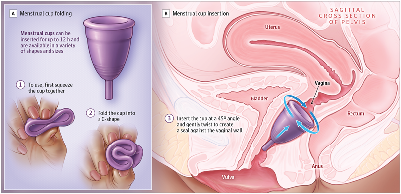 Menstrual cups